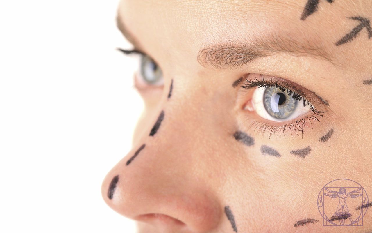 Bl&eacute;pharoplastie